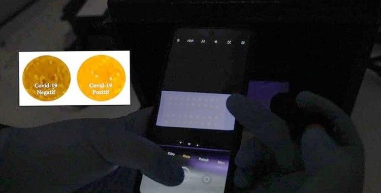 İTÜ Kovid-19'u bir saniyede tespit eden kit geliştirdi