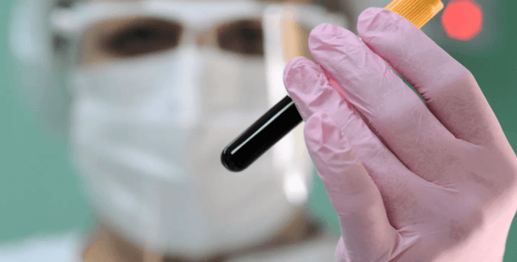 Bilim insanları duyurdu: Erken felç geçirecek kan grubu açıklandı