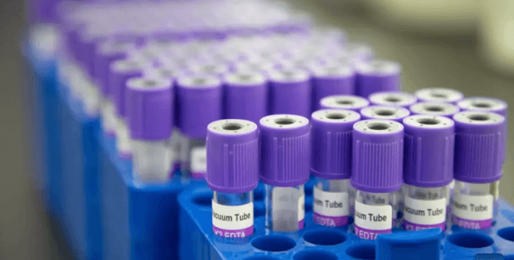 İngiltere’de 12 kanser türünü erken saptayan kan testi deneniyor