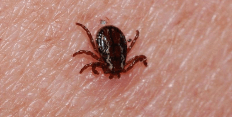 Kayseri'de KKKA tedavisi gören kişi öldü