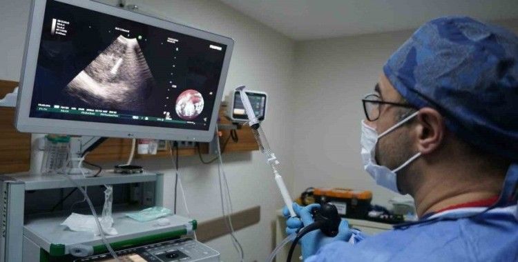 İEÜ Medical Point Hastanesi Akciğer Sağlığı Merkezi’nde EBUS ile ameliyatsız tanı
