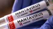 Sağlık Bakanlığından 'hantavirüs' açıklaması: Türk vatandaşların test sonuçları negatif